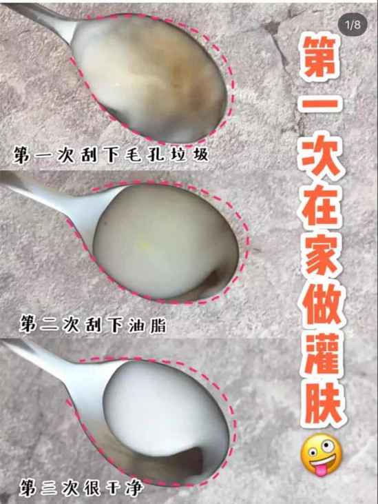 芦荟罐肤可以天天做吗 芦荟灌肤可以每天做吗