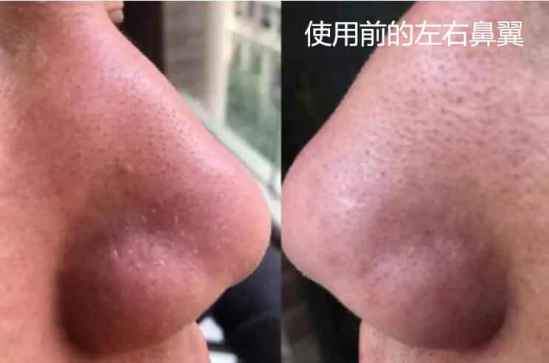 冻膜的正确用法 冻膜怎么使用