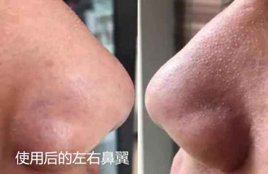 冻膜的正确用法 冻膜怎么使用