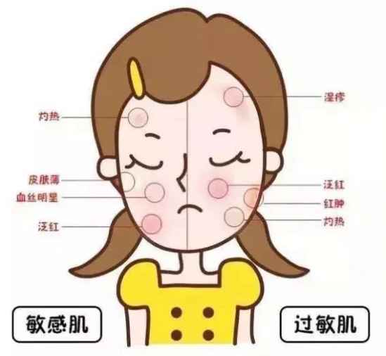 脸过敏可以敷面膜么 脸过敏能不能敷面膜