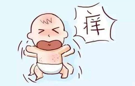 澳洲木瓜膏可以去湿疹吗 澳洲木瓜膏能治湿疹吗